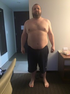 Before Surgery: 307 Pounds (day before surgery)