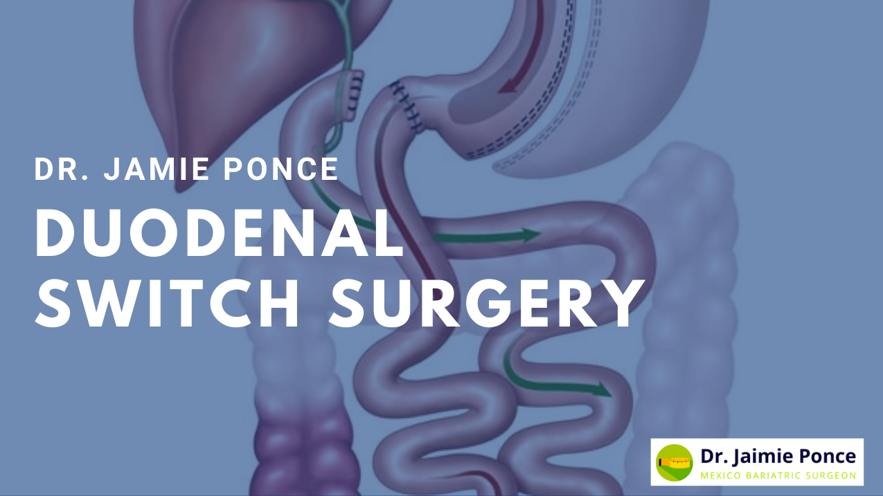 Jamie Ponce Headers Duodenal Switch
